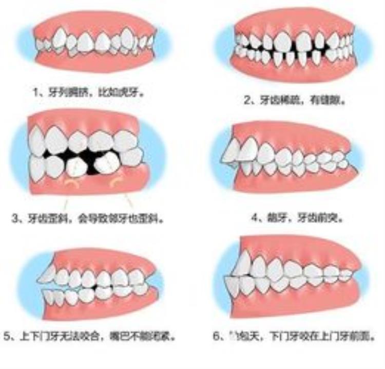 牙齿各类问题「独家整理这7种牙齿问题最容易被忽略90的人都有」