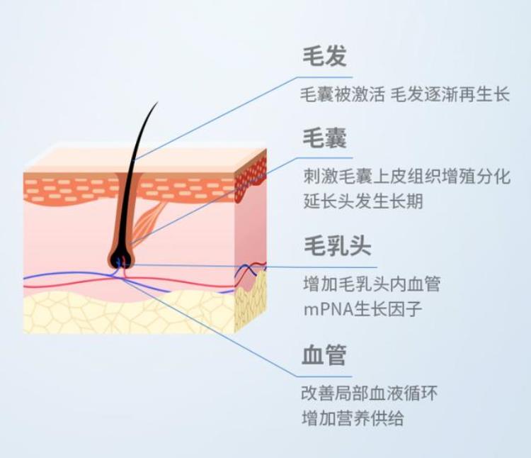 发缝越来越宽千万不要大意这个方法拯救受损毛囊