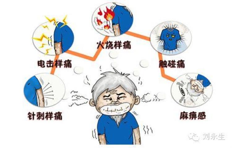 头部一跳一跳的痛就是神经性头痛看医生为你分析