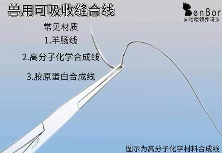 辟谣免拆线比传统缝合更好吗同样的手术为啥有两种缝合措施