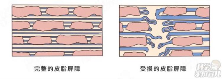 紧急提醒湿疹娃打疫苗后意外致死60湿疹不要用药