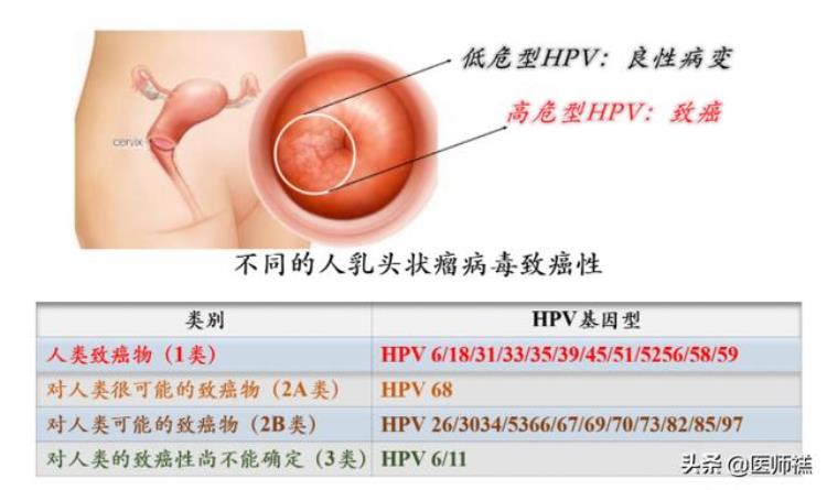 为何总让女性接种hpv疫苗男性就可以置身事外呢「为何总让女性接种HPV疫苗男性就可以置身事外」