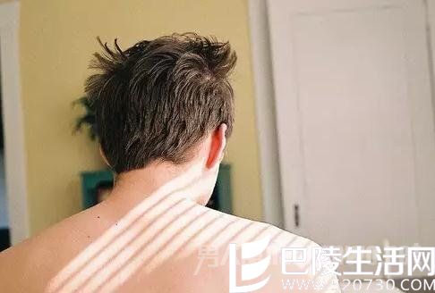 你不丑但你掉发啊 男人必须改变5大坏毛病