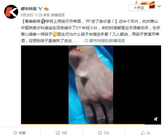 东宝东哥开啤酒走红 5男耍帅学样戳穿手掌