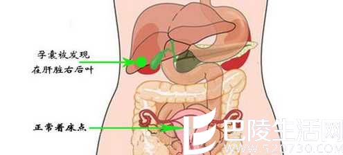 宝宝怀在肝脏上 吸血宝宝惊现人间?