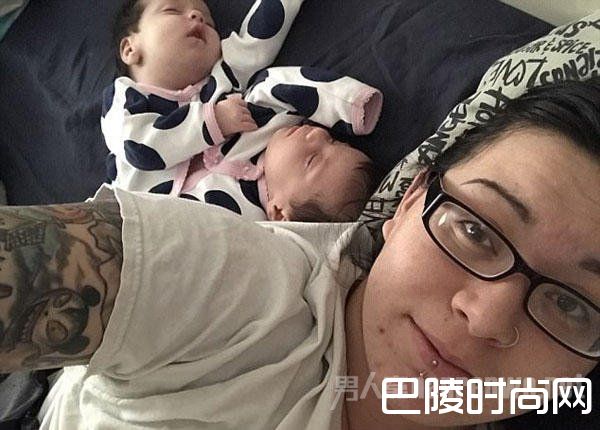 母爱的力量 女子坚持诞下连体双胞胎孩子十分健康