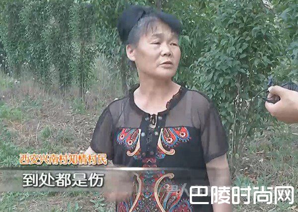 女童被恶犬围攻身亡 现场十分血腥惨不忍睹