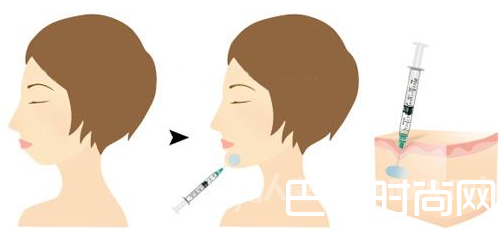 立秀膨体垫下巴：这效果我给100分！