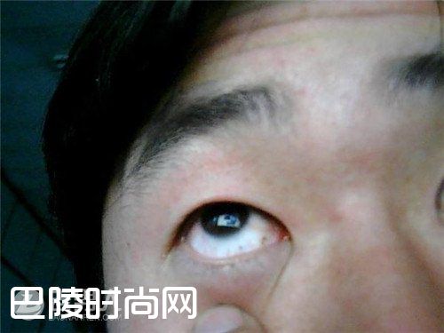 男人山根有横纹 男人桃花眼|眉毛弯的男人 眼中有痣的男人