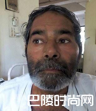 印度男子体内被插75根针 难不成是被容嬷嬷托梦扎的？