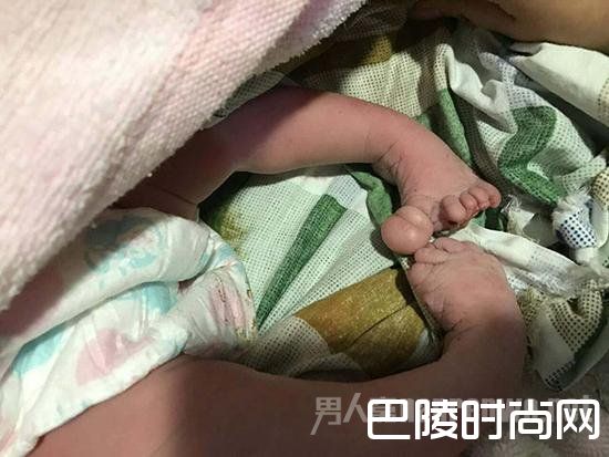 六次彩超均被告知发育正常 孕妇生下手足畸形儿