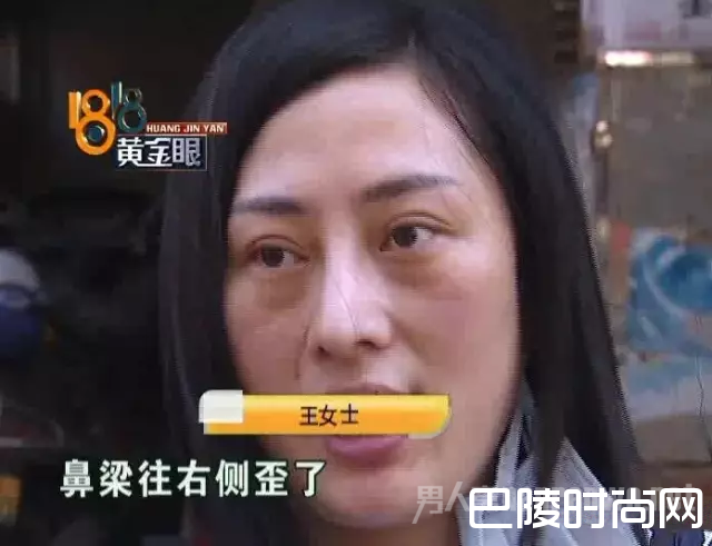 越南女子花十万整容闪婚嫁给富二代 之前真的太丑了！