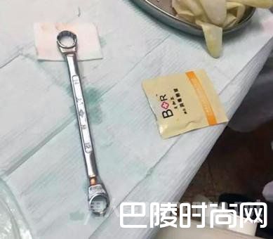 太尴尬！ 男子下体被扳手套住最后口腔医生来解围