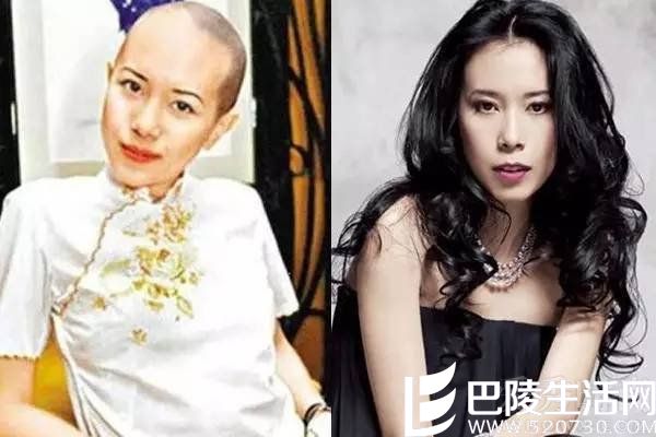 光头杨幂美翻了 这些女明星的光头造型是你没见过的