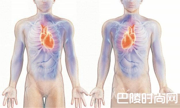 男子五脏六腑颠倒怎么回事？直肠癌切除手术愁坏医生