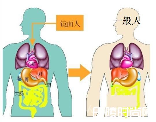 男子五脏六腑颠倒怎么回事？直肠癌切除手术愁坏医生