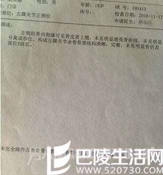 大学生上课抖腿致骨折 抖腿有风险不良习惯得改掉