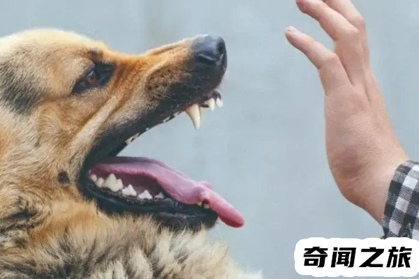 一针狂犬疫苗价格表（狂犬疫苗有几种价格）