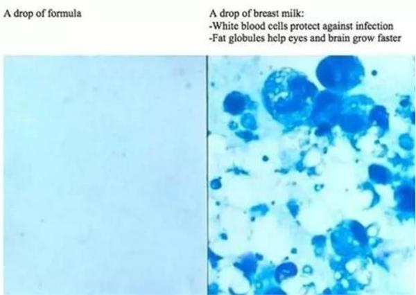 显微镜下母乳和奶粉成分有什么不同