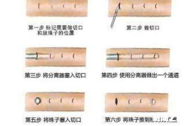 男戴珠什么意思（主要是为了增强男性战斗力）