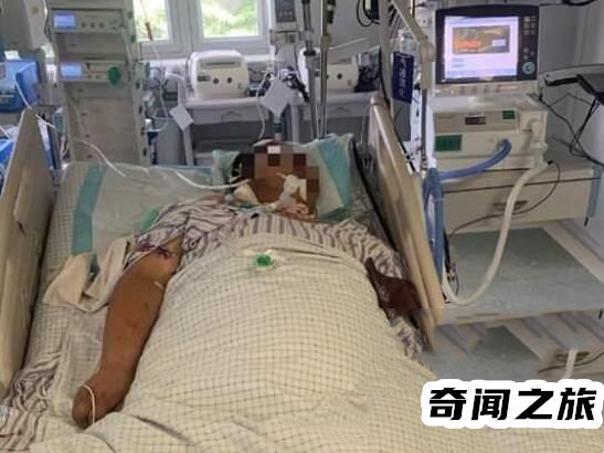 一快递员因热射病进icu（要警惕中暑必须马上离开高热环境）