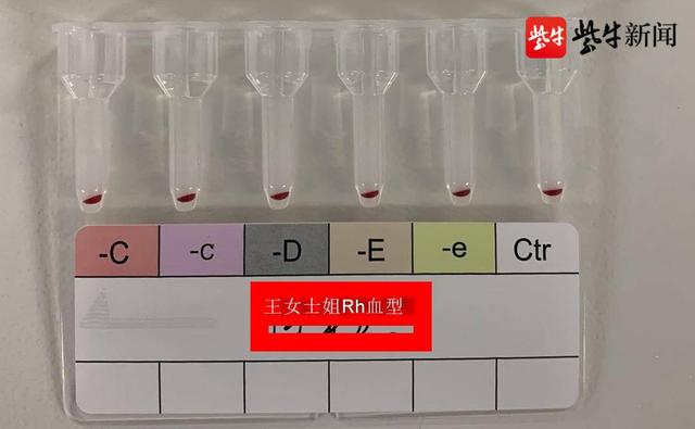 江苏发现最罕见血型（该血型被称为黄金血型）