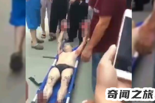 男子跳水失败最终感染死亡（跳水失误头砸跳板流血）