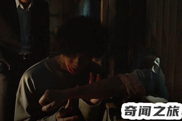 食面男事件(街头流浪汉被人撕咬掉半张脸)