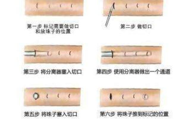 入珠是什么样的（入珠是什么意思）