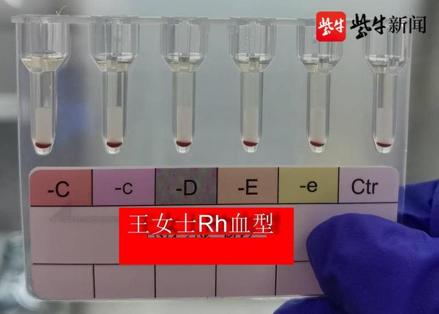 江苏发现最罕见血型（该血型被称为黄金血型）