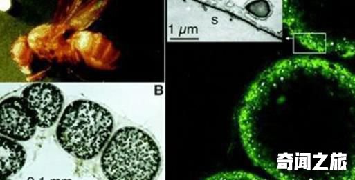 世界上最大的细菌 纳米比亚珍珠硫细菌阔度有0.1-0.3毫米