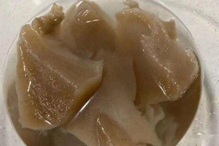 血糖高怎么调理才会降?这五个食物辅助降血糖血压