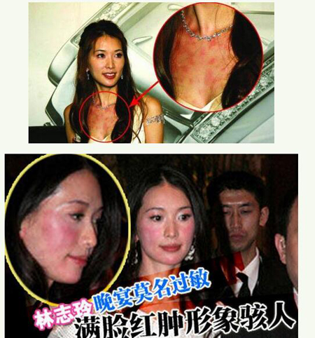 中国卸妆后最丑女明星烂脸爆痘照