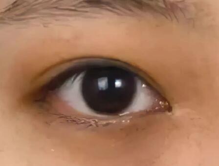 熬夜黑眼圈怎么去除？这五个方法拯救肌肤改善黑眼