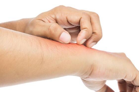 全身发痒是怎么回事?这四个因素造成要及时治疗