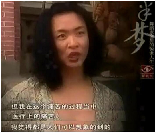 金星为什么要变性手术男变女过程