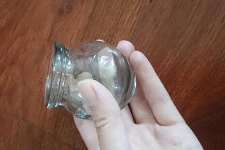 拔罐后皮肤会有印记是毒素多?(拔火罐有好处吗?)