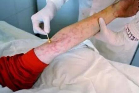 艾滋病感染多久才知道?(艾滋病有什么症状表现?)