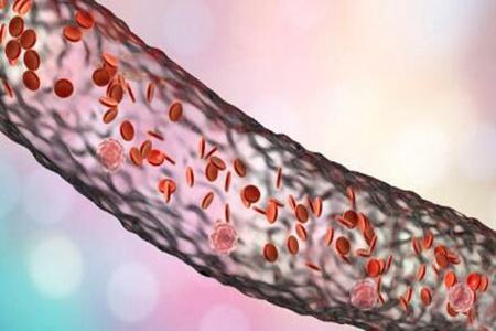血栓是怎么形成和引起的？这四个因素有着极为密切的联系