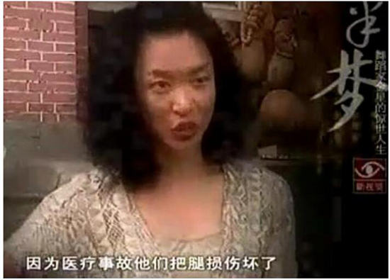 金星为什么要变性手术男变女过程