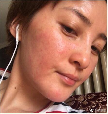 中国卸妆后最丑女明星烂脸爆痘照