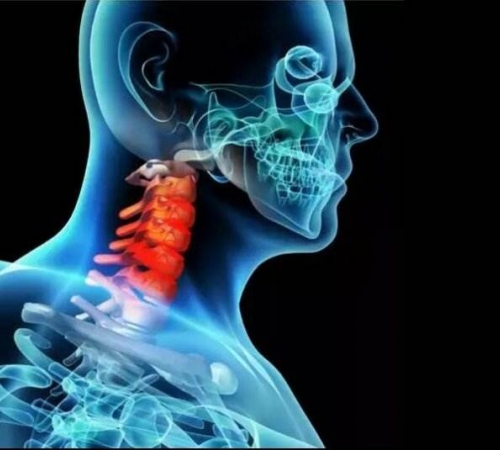 女性颈椎病疼痛缓解方案