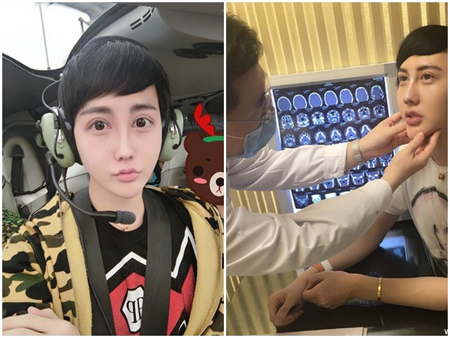 蛇精男找医生鉴定 蛇精男整形鉴定视频公开！