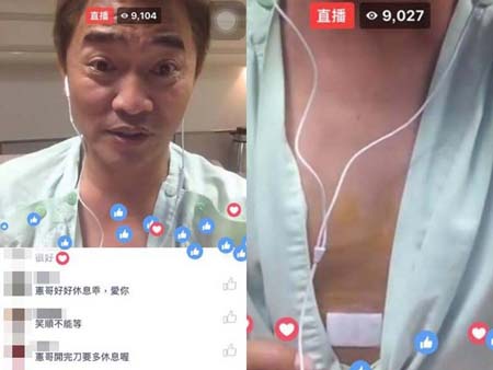 吴宗宪胆结石住院不忘直播 吴宗宪被判刑22个月