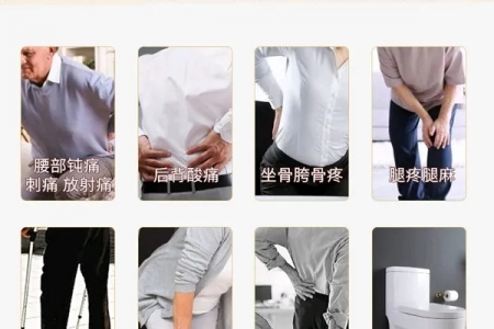 腰间盘突出怎么治疗最好的方法 专家这样说