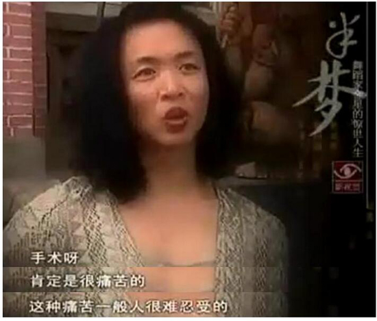 金星为什么要变性手术男变女过程