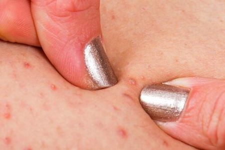 脖子上长个疙瘩是怎么回事?这五个原因情况可轻可重不可忽视