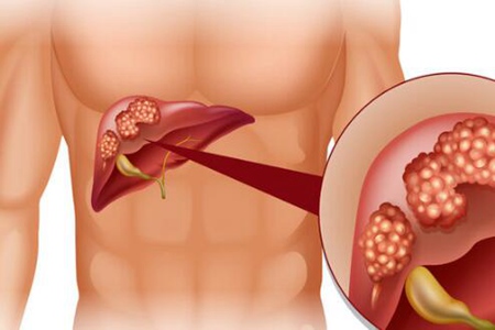 怎么养肝护肝？牢记这4个原则整年身体都棒棒哒