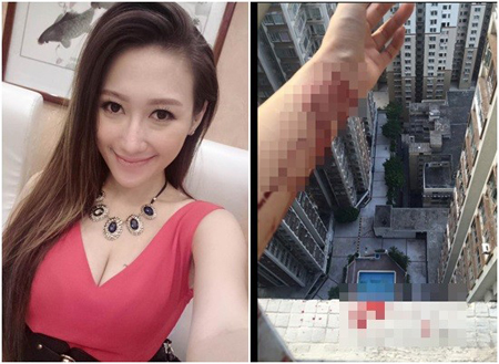 辣模直播跳海！急救醒来“什么都不记得”