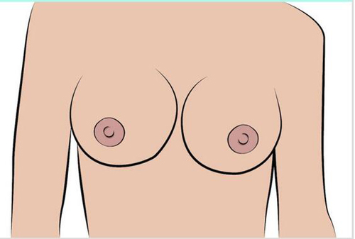 乳头形状有几种图片